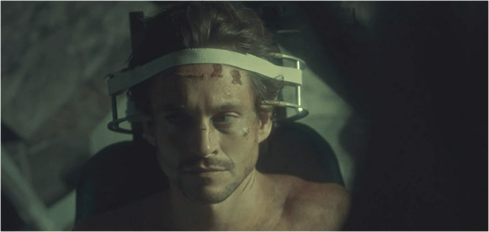 Hannibal 3.07 Will surgery
